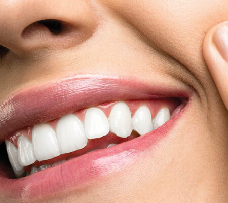 teeth1