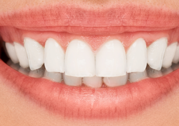teeth2