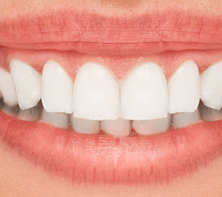teeth2