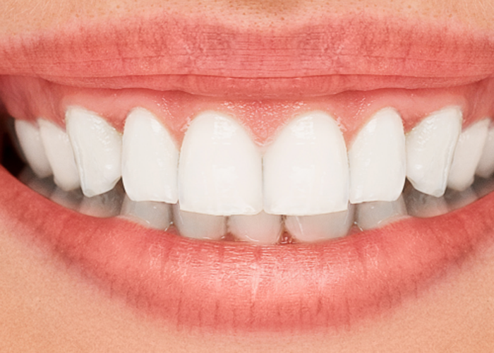teeth2