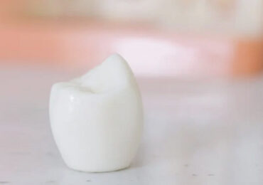 implant1