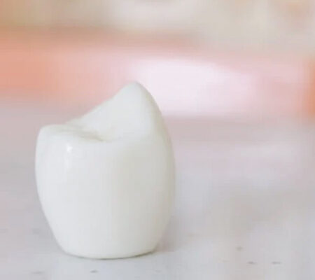 implant1